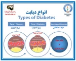 دیابت و انواع آن 